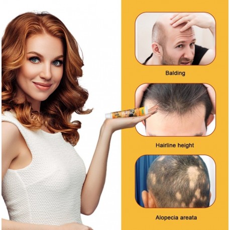 Крем для роста волос Sumifun Bee Venom Alopecia Hair Growth Cream 20 г оптом-2