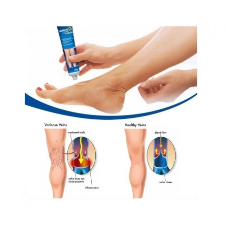 Крем Sumifun Varicose Veins Cream Natural Ingredients от варикоза 20 г оптом-4