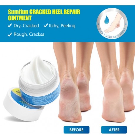 Крем-мазь Sumifun Cracked Heel Repair Ointment от трещин, мозолей на стопах 30 мл оптом-5