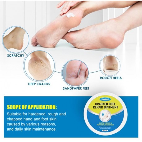 Крем-мазь Sumifun Cracked Heel Repair Ointment от трещин, мозолей на стопах 30 мл оптом-8