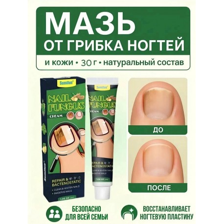 Крем-мазь Sumifun Nail Fungus Cream от онихомикоза ногтей на ногах 30 г оптом-3