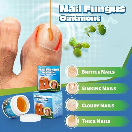 Крем-мазь Sumifun Nail Fungus Ointment от вросших ногтей, для лечения паронихии 20 г оптом-4