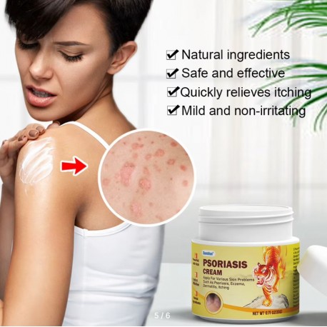 Крем-мазь Sumifun Psoriasis Cream при дерматите, псориазе 20 г оптом-5