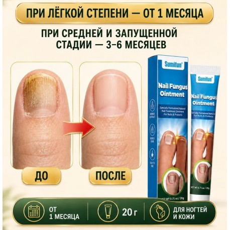 Мазь Sumifun Nail Fungus Ointment для лечения паронихии 20 г оптом-2