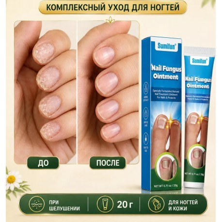 Мазь Sumifun Nail Fungus Ointment для лечения паронихии 20 г оптом-7