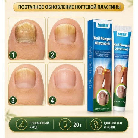 Мазь Sumifun Nail Fungus Ointment для лечения паронихии 20 г оптом-8