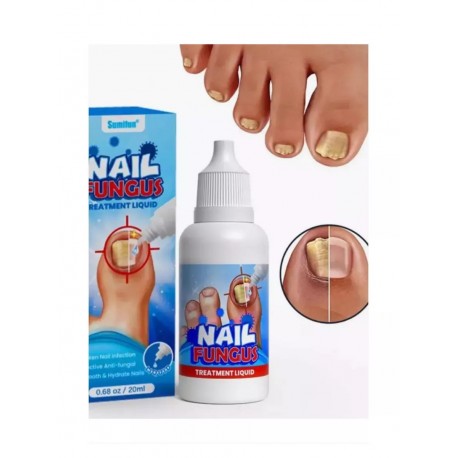 Средство-капли Sumifun Nail Fungus Treatment Liquid от онихомикоза 20 мл оптом-3