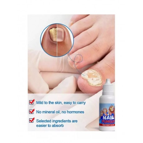 Средство-капли Sumifun Nail Fungus Treatment Liquid от онихомикоза 20 мл оптом-4
