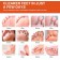 Спрей Sumifun Athlete's Foot Spray от грибка стоп и потливости 30 мл оптом