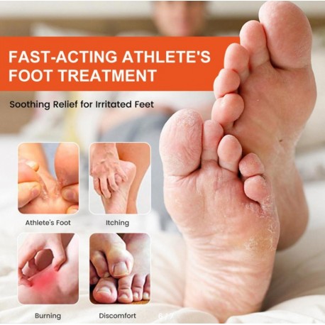 Спрей Sumifun Athlete's Foot Spray от грибка стоп и потливости 30 мл оптом-6