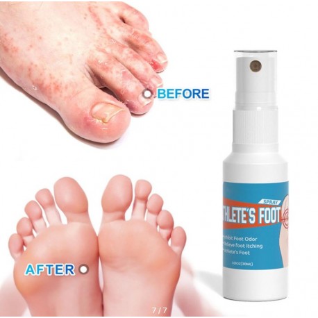 Спрей Sumifun Athlete's Foot Spray от грибка стоп и потливости 30 мл оптом-7