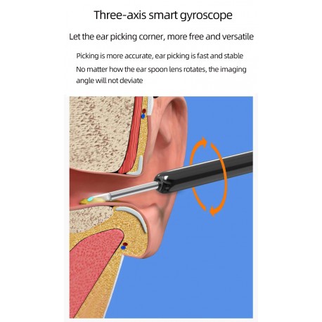 Беспроводной высокоточный удалитель ушной серы NE3 Wireless Visible Earpick с камерой  оптом-7