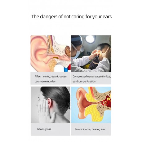 Беспроводной высокоточный удалитель ушной серы NE3 Wireless Visible Earpick с камерой  оптом-16