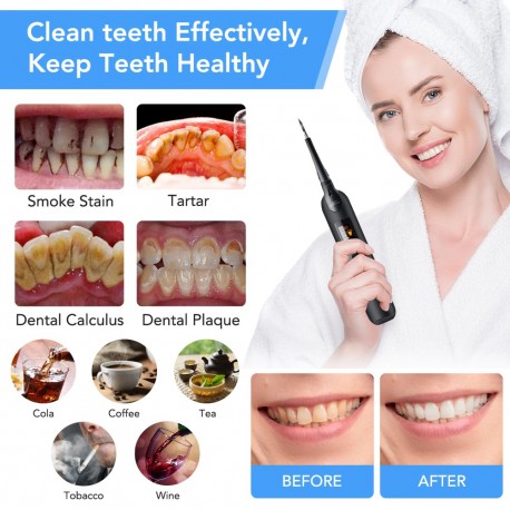 Электрический ультразвуковой отбеливатель для зубов Home Use Dental tools  оптом-8