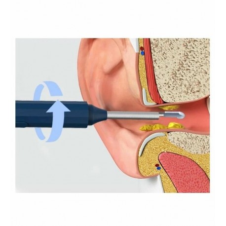 Прибор для чистки ушей Ear Wax Removal with Camera с камерой  оптом-7