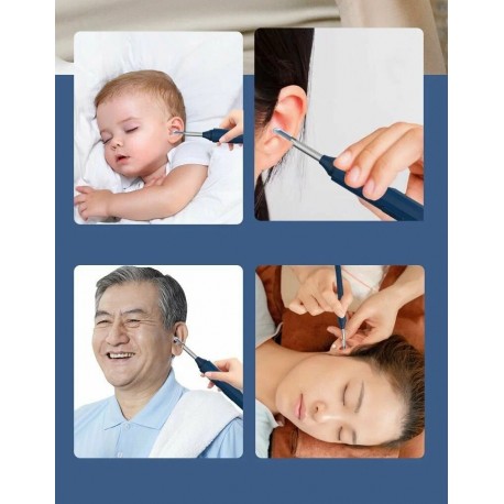 Прибор для чистки ушей Ear Wax Removal with Camera с камерой  оптом-10