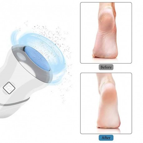 Беспроводная электрическая пенза для ног, 2 скорости  оптом-5