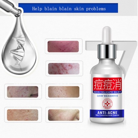 Сыворотка для проблемной кожи Bioaqua Anti Acne Skin Delicate Silky 30 мл  оптом-2