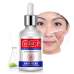 Сыворотка для проблемной кожи Bioaqua Anti Acne Skin Delicate Silky 30 мл оптом