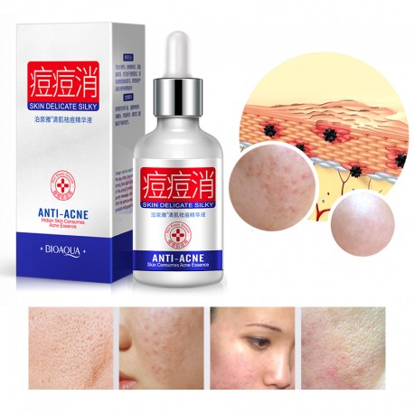 Сыворотка для проблемной кожи Bioaqua Anti Acne Skin Delicate Silky 30 мл  оптом-4