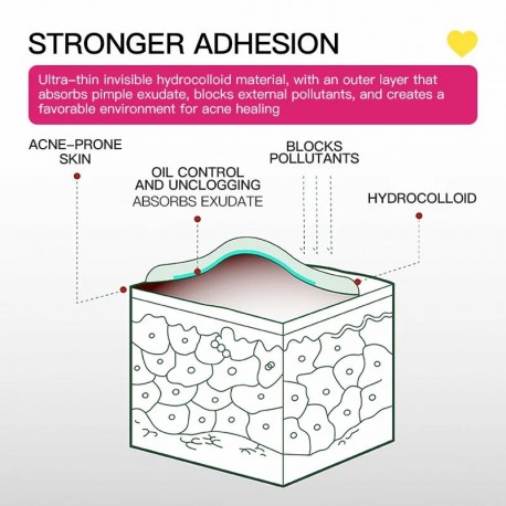 Пластыри для лица ACNE PATCH от прыщей 4 цвета, 48 шт  оптом-3