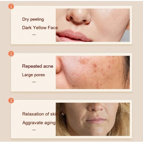 Ручной кислородный инжектор нано-спрей MGE-410 для увлажнения лица  оптом-5