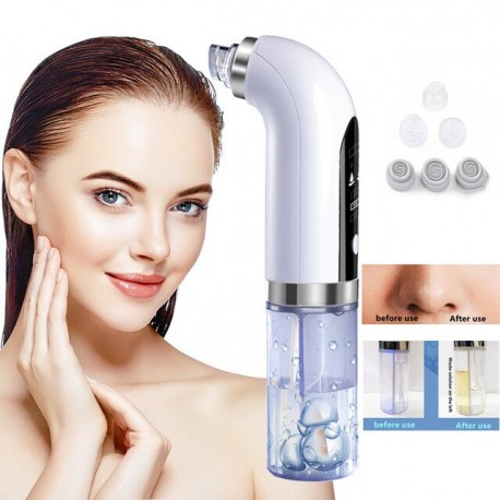 Вакуумный аппарат для очистки пор Super Micro Bubble Beauty Instrument  оптом-5