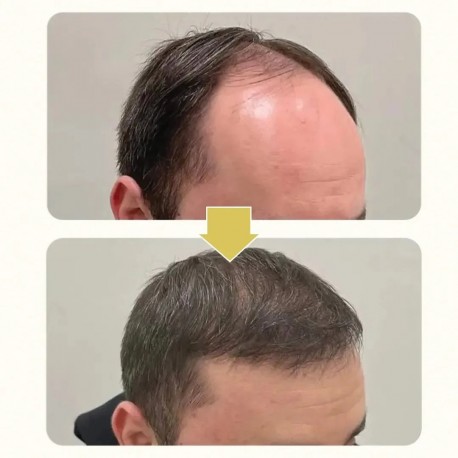 Кондиционер для волос KORMESIC Professional Hair Care 5% Minoxidil & Keratin Conditioner 265 мл оптом-3