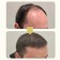 Кондиционер для волос KORMESIC Professional Hair Care 5% Minoxidil & Keratin Conditioner 265 мл оптом