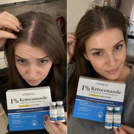 Набор KORMESIC 1% Ketoconazole Anti-Dandruff Topical Solution для кожи головы 5 х 50 мг+5 х 3 мл оптом-5