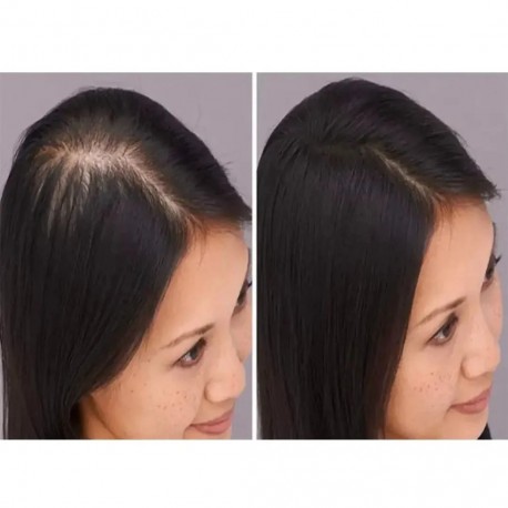 Шампунь для укрепления волос KORMESIC 5% Minoxidil with Biotin Shampoo 300 мл оптом-4