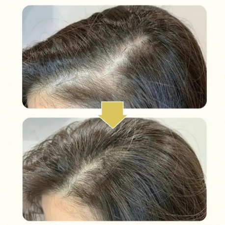 Шампунь для волос KORMESIC Professional Hair Care 5% Minoxidil & Keratin Shampoo 265 мл оптом-3