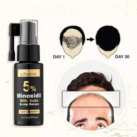 Сыворотка-спрей KORMESIC 5% Minoxidil with Biotin Scalp Serum для роста волос против выпадения 30 мл оптом-5