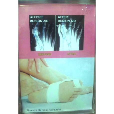 Фиксатор Hallux Valgus (пластик) 2 штуки  оптом-3