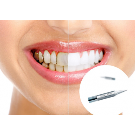 Карандаш для отбеливания зубов luxury white  оптом-1