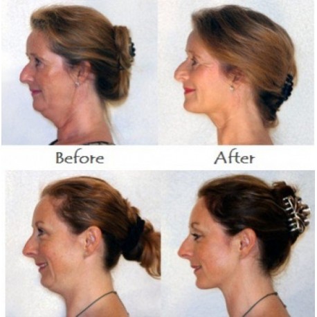 Тренажер для подбородка Neckline Slimmer  оптом-3